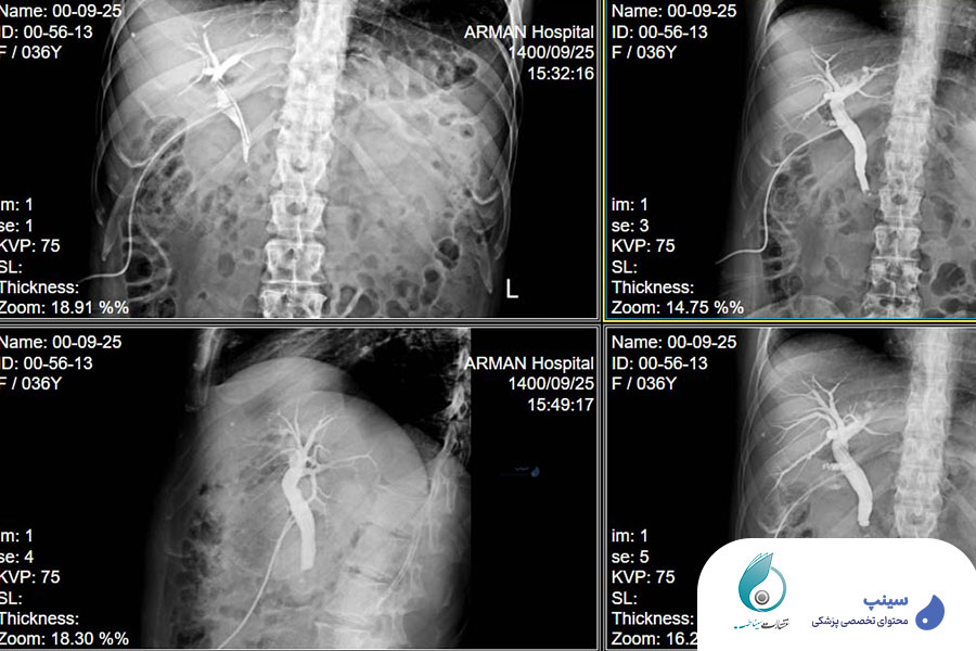 آموزش رادیولوژی پرکتیکال